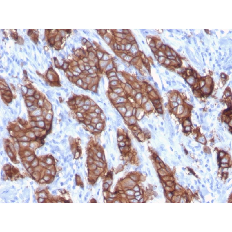 HER-2 / c-erbB-2 / neu / CD340(ERBB2/3093), CF640R conjugate, 0.1mg/mL