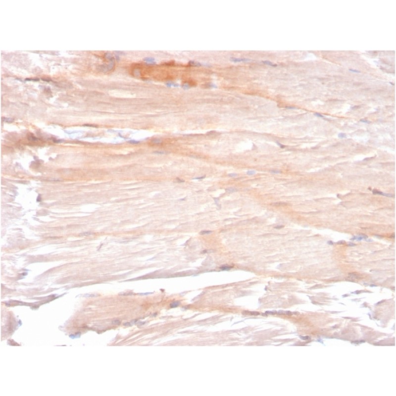 Dystrophin (DMD) (Marker of Duchenne and Becker Muscular Dystrophy)(DMD/3241), CF640R conjugate, 0.1mg/mL