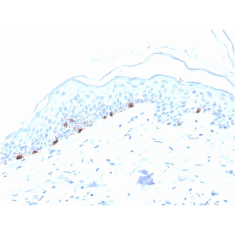 Tyrosinase-Related Protein-1 (TYRP-1) (Melanoma Marker)(TYRP1/3280), CF640R conjugate, 0.1mg/mL
