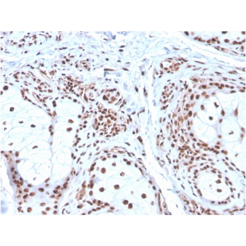 Nucleophosmin (Acute Myeloid Leukemia Marker)(NPM1/3286), CF640R conjugate, 0.1mg/mL