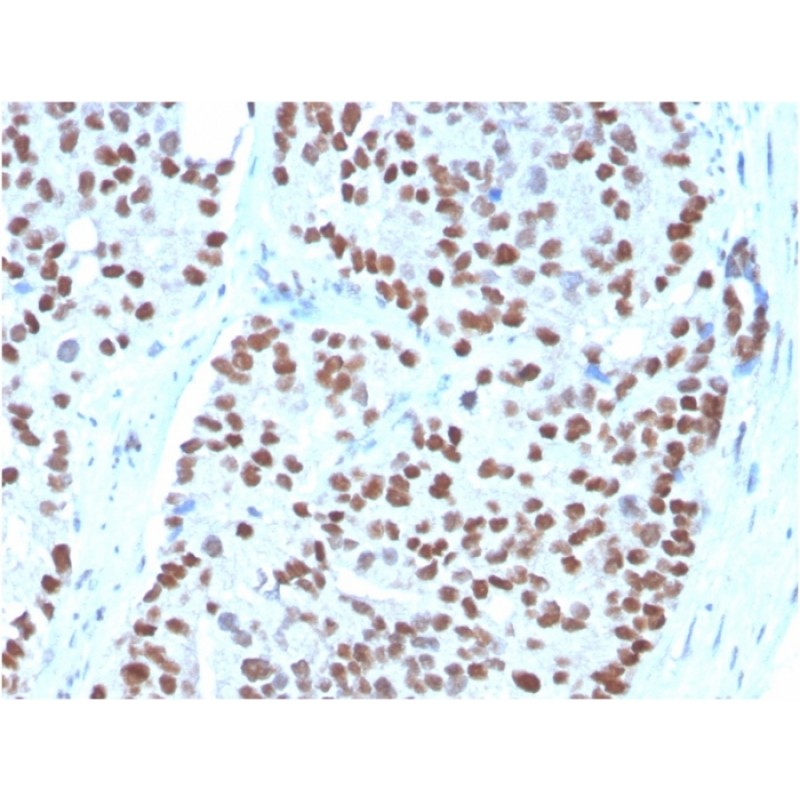 NKX3.1 (Metastatic Prostate Adenocarcinoma Marker)(NKX3.1/3348), CF640R conjugate, 0.1mg/mL
