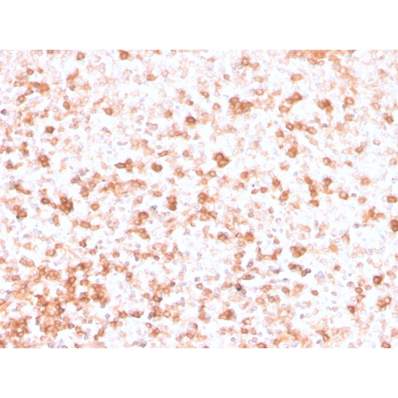 Human Lambda Light Chain (B-Cell Marker)(rLLC/3777), CF640R conjugate, 0.1mg/mL