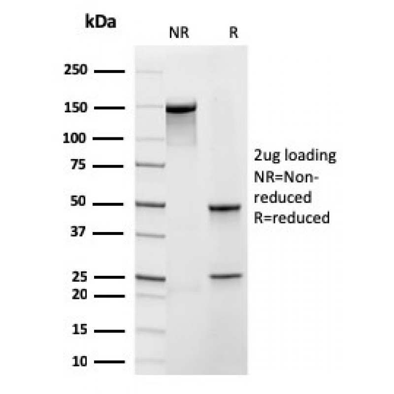 Frataxin (Mitochondrial Marker)(rFXN/2124), CF640R conjugate, 0.1mg/mL
