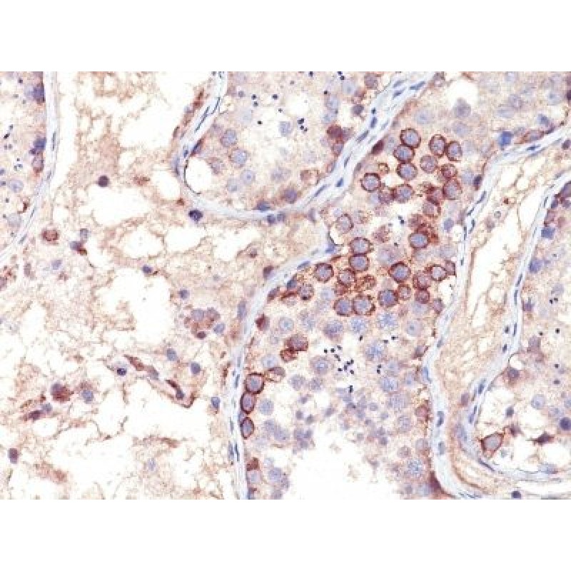 MAGE A1(MA454), CF647 conjugate, 0.1mg/mL