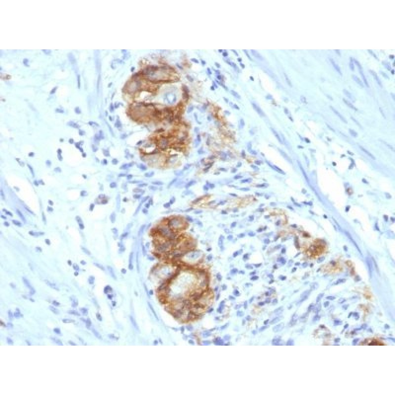 CD56 / NCAM(123C3.D5), CF647 conjugate, 0.1mg/mL