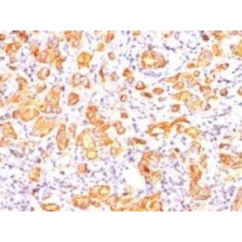 Mucin 1 / EMA / Episialin / CD227(GP1.4), CF647 conjugate, 0.1mg/mL