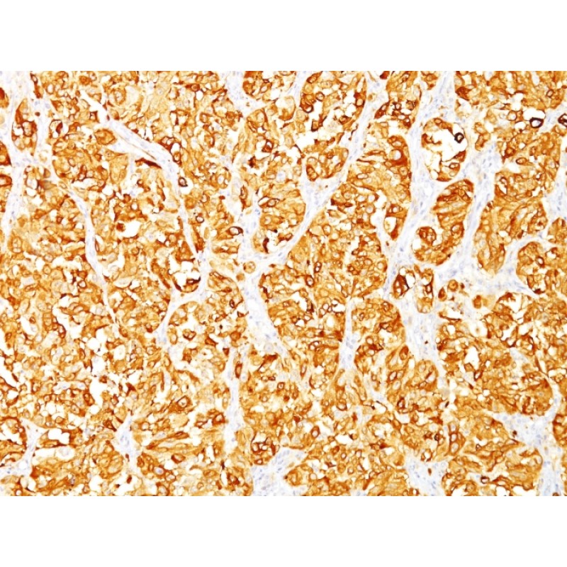 MART-1 / Melan-A / MLANA (Melanoma Marker)(DT101 + BC199),  CF647 conjugate, 0.1mg/mL