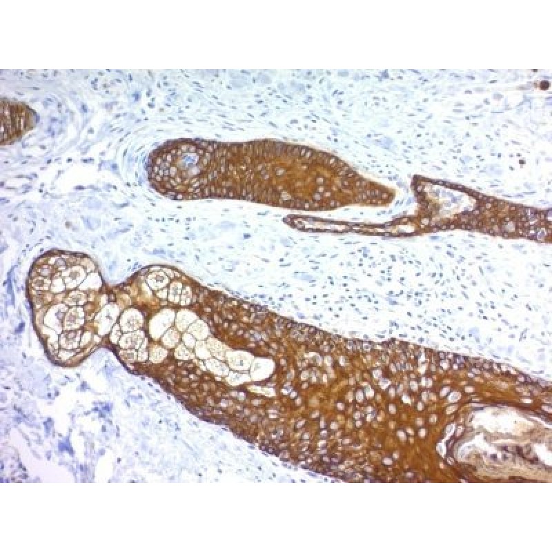 Cytokeratin, HMW(KRTH/1076), CF647 conjugate, 0.1mg/mL