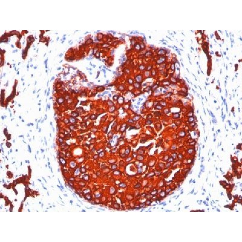 Cytokeratin, pan(KRTL/1077 + KRTH/1076), CF647 conjugate, 0.1mg/mL
