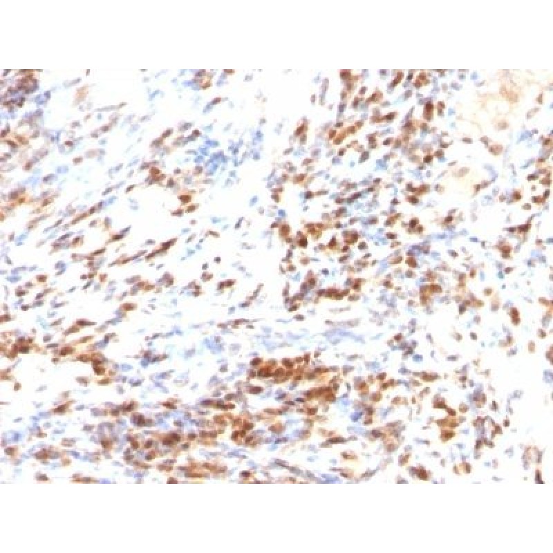 p27 / KIP1(DCS-72.F6 + KIP1/769 (SX53G8)), CF647 conjugate, 0.1mg/mL