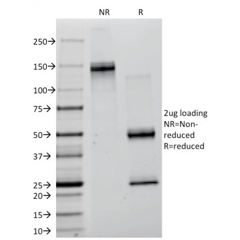 Creatine Kinase-BB (CK-BB) (CKBB/1268), CF647 conjugate, 0.1mg/mL