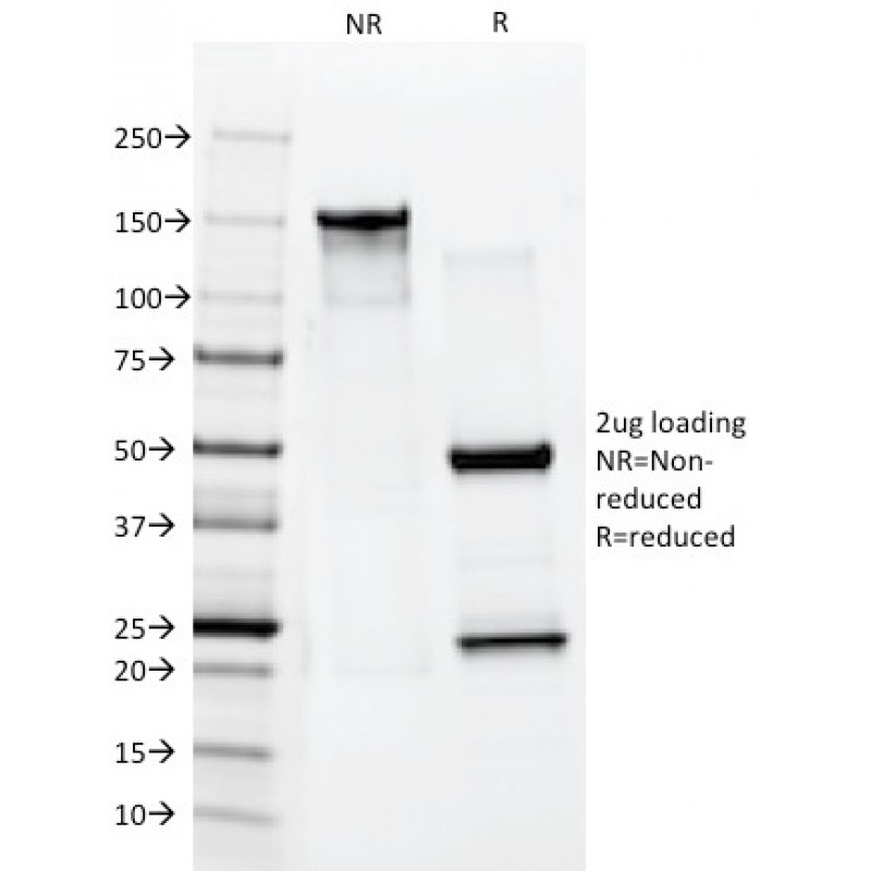 Cytokeratin 10 (Suprabasal Epithelial Marker)(AE20), CF647 conjugate, 0.1mg/mL