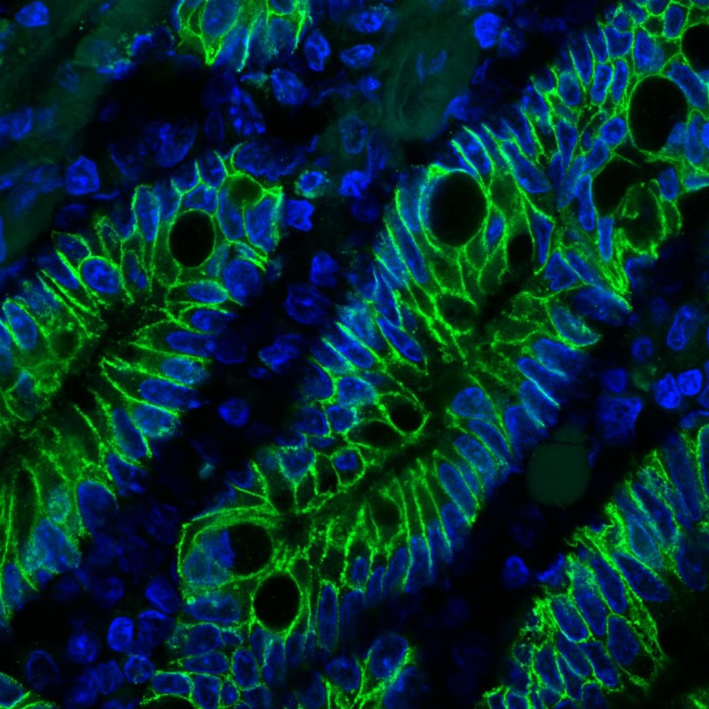 Ep-CAM / CD326 (Extracellular Domain) (Epithelial Marker) (EGP40/1372), CF647 conjugate, 0.1mg/mL