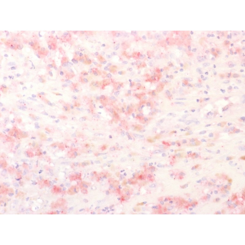 Tyrosinase-Related Protein-1 (TYRP-1) (Melanoma Marker), CF647 conjugate, 0.1mg/mL