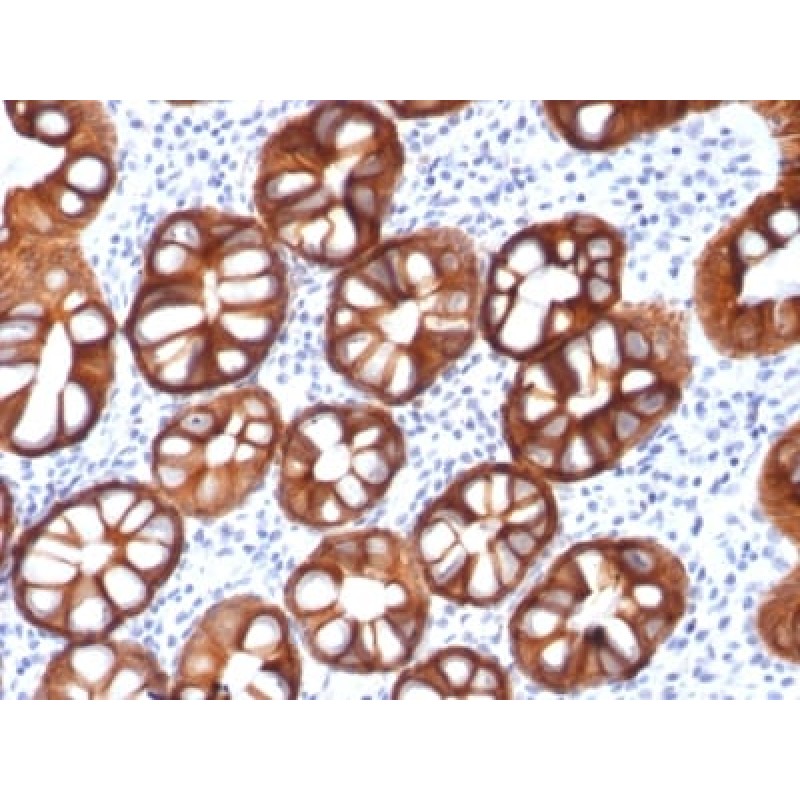 Ep-CAM / CD326 (Epithelial Marker) (rMOC-31), CF647 conjugate, 0.1mg/mL