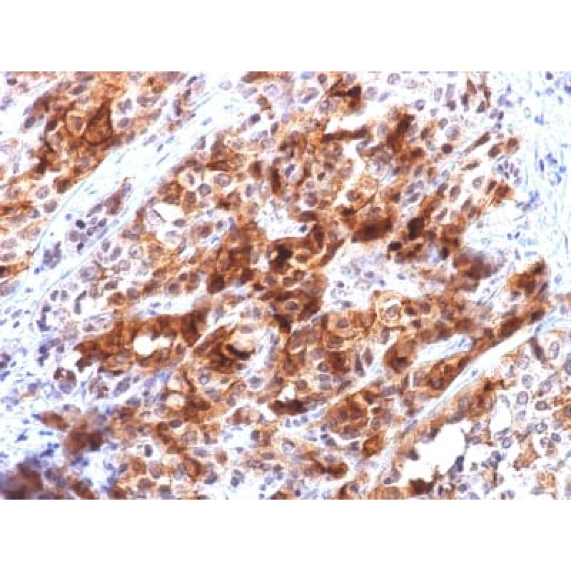 Glypican-3 (GPC3) (Hepatocellular Carcinoma Marker) (rGPC3/863), CF647 conjugate, 0.1mg/mL