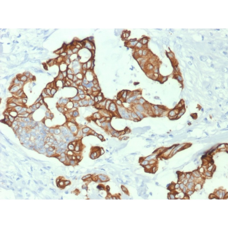 Cytokeratin 20 (KRT20) (Colorectal Epithelial Marker) (KRT20/1992), CF647 conjugate, 0.1mg/mL