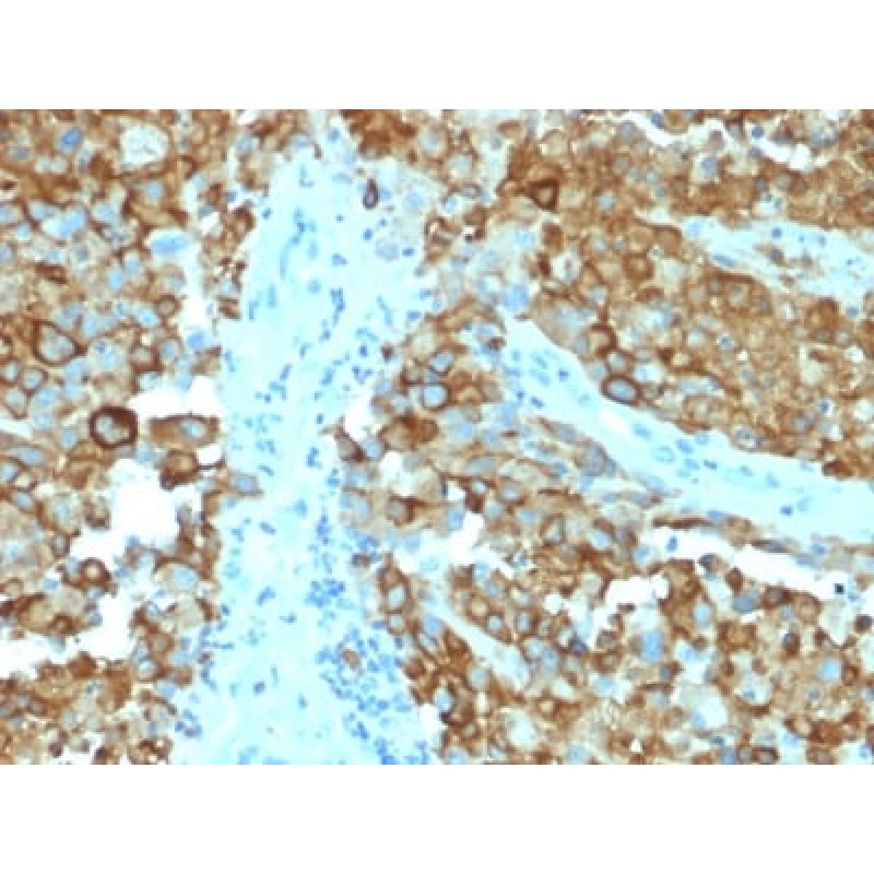 gp100 / Melanosome / PMEL17 / SILV (Melanoma Marker) (PMEL/2038), CF647 conjugate, 0.1mg/mL