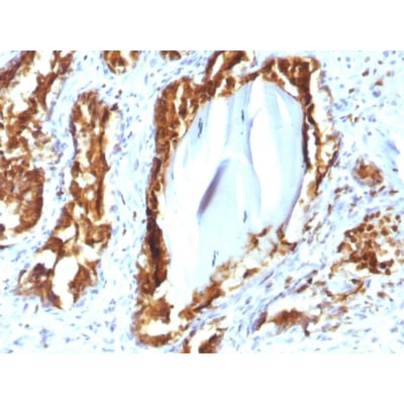 Prostate Specific Acid Phosphatase (PSAP) (rACPP/1338), CF647 conjugate, 0.1mg/mL