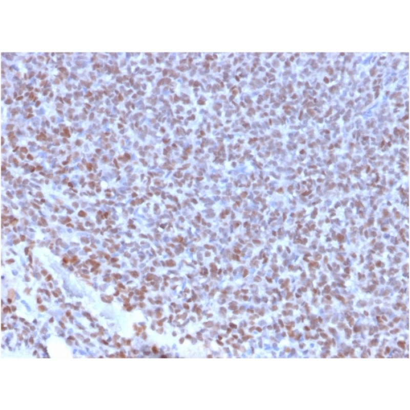 NKX2.2 (Neuroendocrine & Ewing's Sarcoma Marker)(NX2/2198R), CF647 conjugate, 0.1mg/mL
