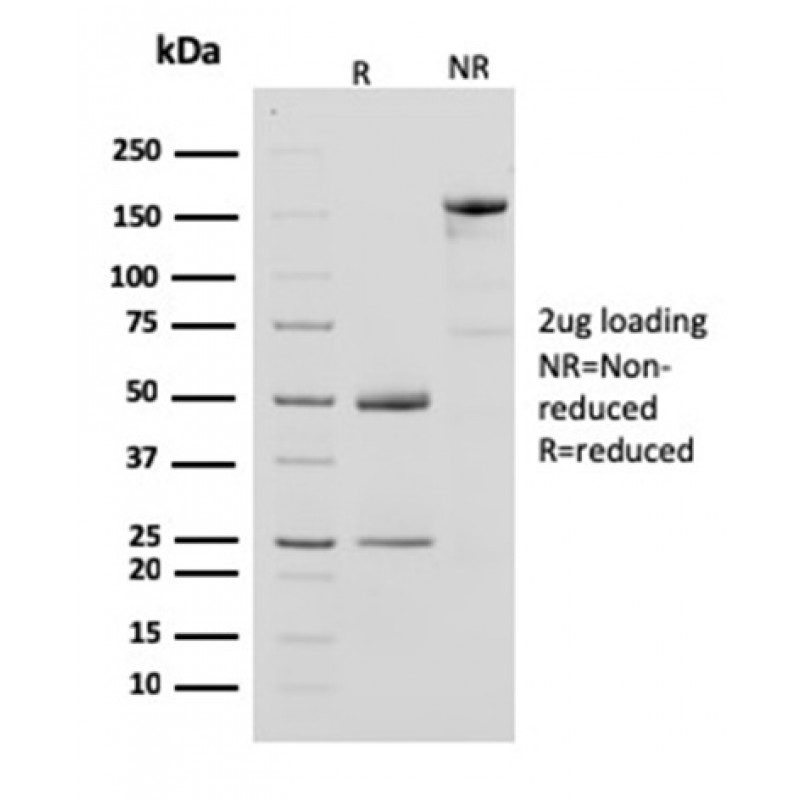 Creatine Phosphokinase-BB (CK-BB)(CPTC-CKB-2), CF647 conjugate, 0.1mg/mL