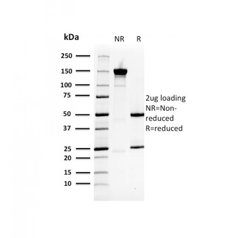 Heat Shock 27kDa Protein 1 (HPS27)(CPTC-HSPB1-2), CF647 conjugate, 0.1mg/mL