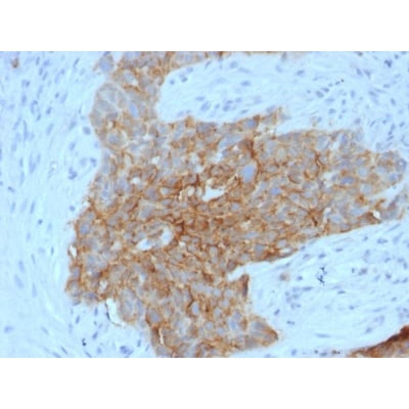 GLUT-1 (Tumor Progression and Mesothelioma Marker) (GLUT1/2475), CF647 conjugate, 0.1mg/mL