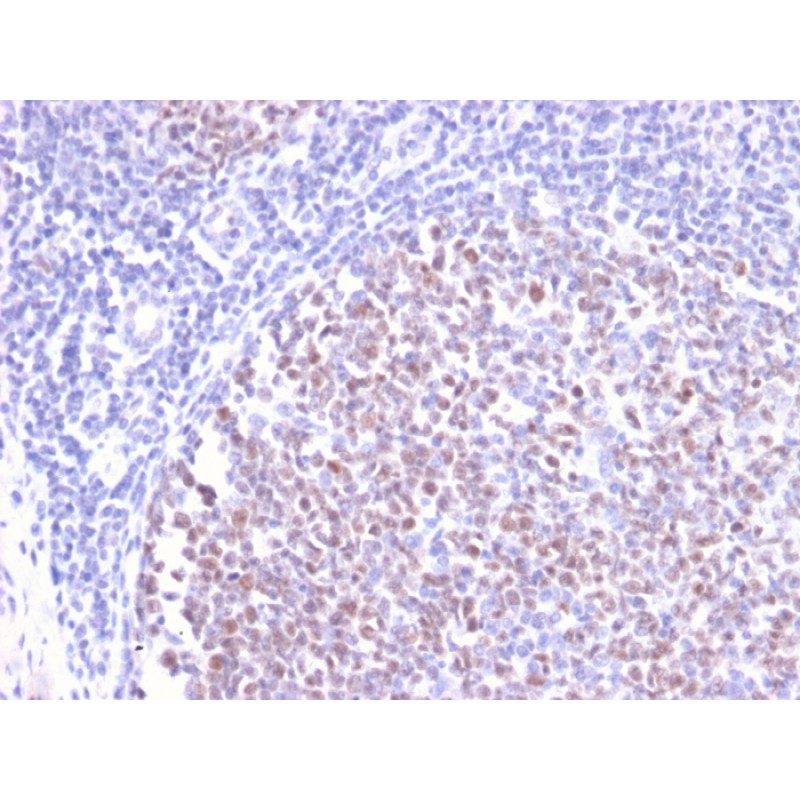 Biotium BNC472497-100, Bcl-6 (Follicular Lymphoma Marker)(BCL6/2497R), CF647 conjugate, 0.1mg/mL