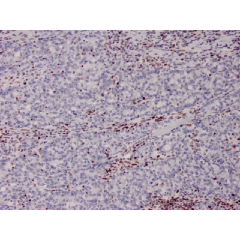 MSH2 (DNA Mismatch Repair Marker)(MSH2/2622), CF647 conjugate, 0.1mg/mL