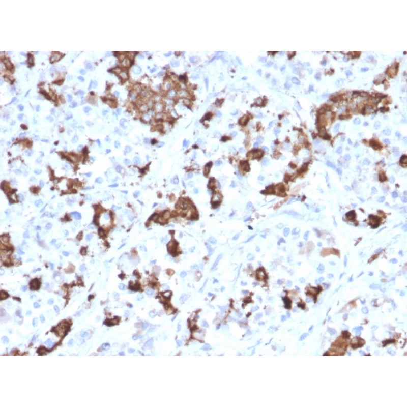 Prolactin (Pituitary Tumor Marker)(PRL/2644), CF647 conjugate, 0.1mg/mL