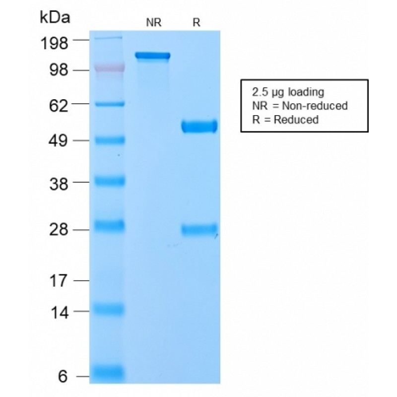 VLDL-Receptor (Very Low Density Lipoprotein Receptor)(VLDLR/2896R), CF647 conjugate, 0.1mg/mL