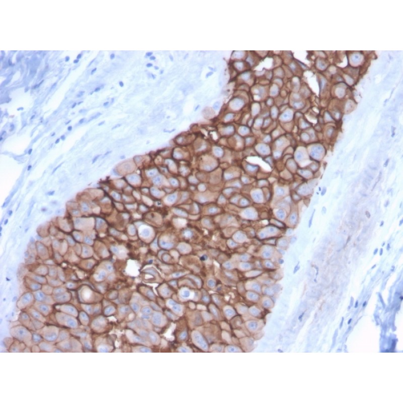 HER-2 / c-erbB-2 / neu / CD340(ERBB2/3092), CF647 conjugate, 0.1mg/mL