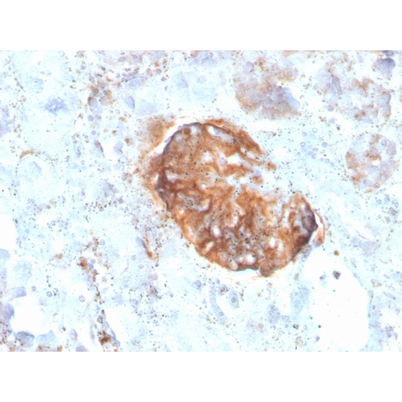 MTAP (Tumor Suppressor Marker)(rMTAP/1813), CF647 conjugate, 0.1mg/mL