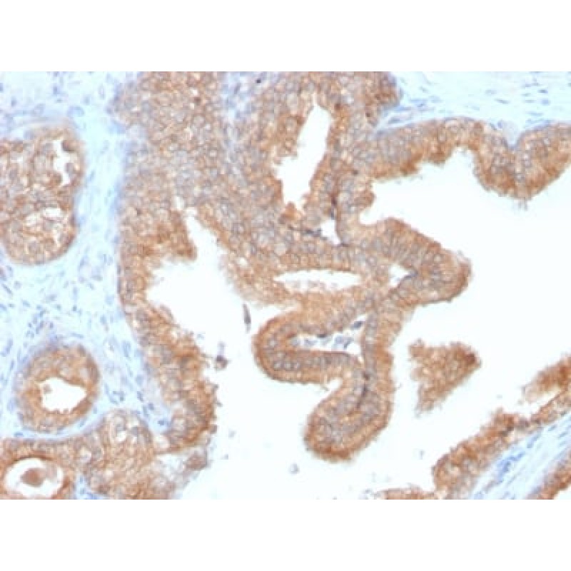 Biotium BNC552748-500, AMACR / p504S (Prostate Cancer Marker) (AMACR/2748R), CF555 conjugate, 0.1mg/mL