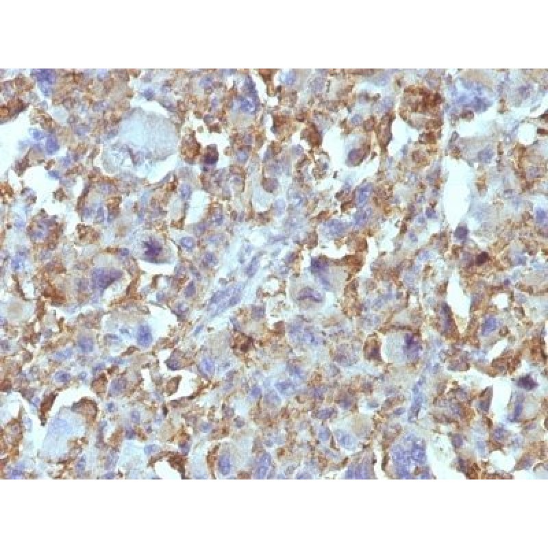 Small Cell Lung Cancer (SCLC)(MOC-52), CF568 conjugate, 0.1mg/mL