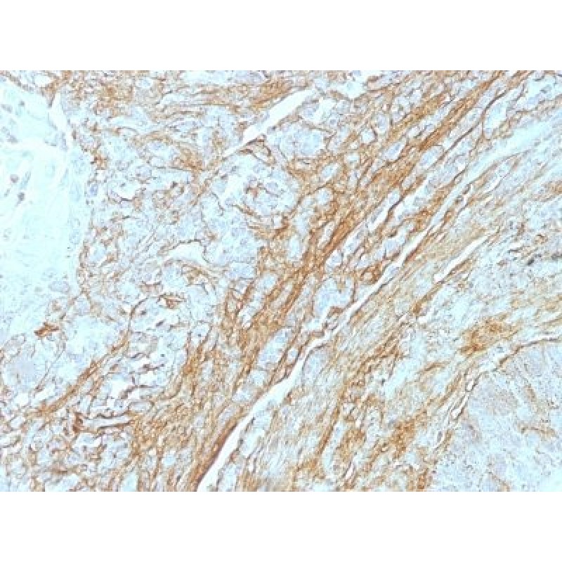 Tenascin(T2H5), CF568 conjugate, 0.1mg/mL