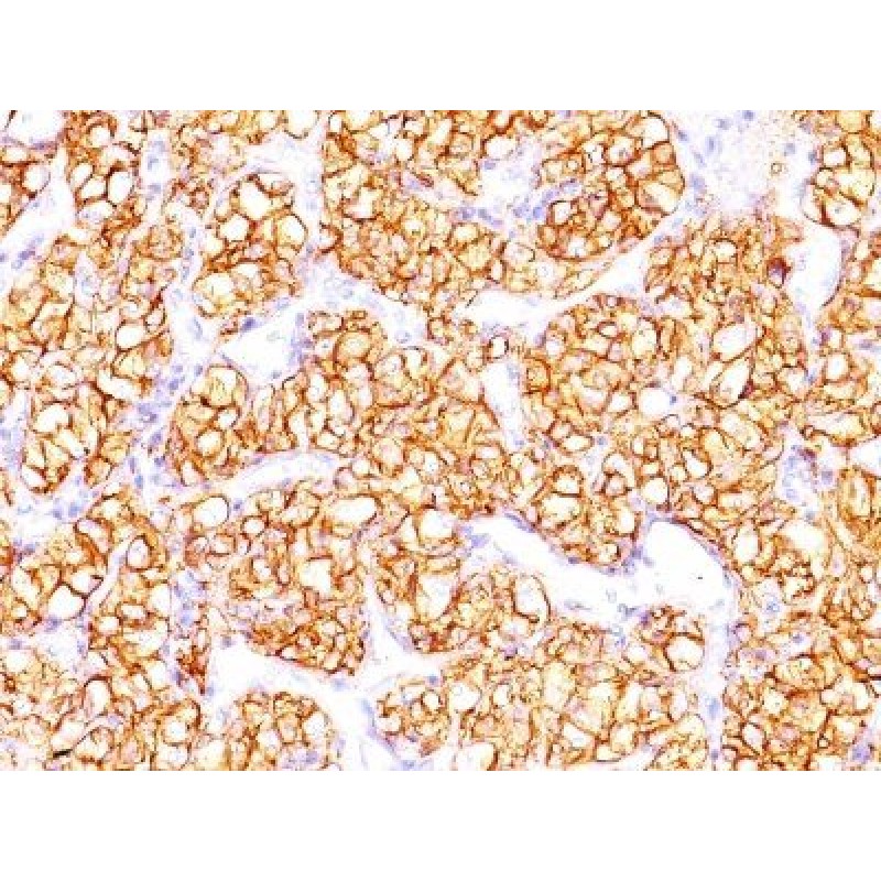Renal Cell Carcinoma (Carbonic Anhydrase IX)(PN-15), CF568 conjugate, 0.1mg/mL