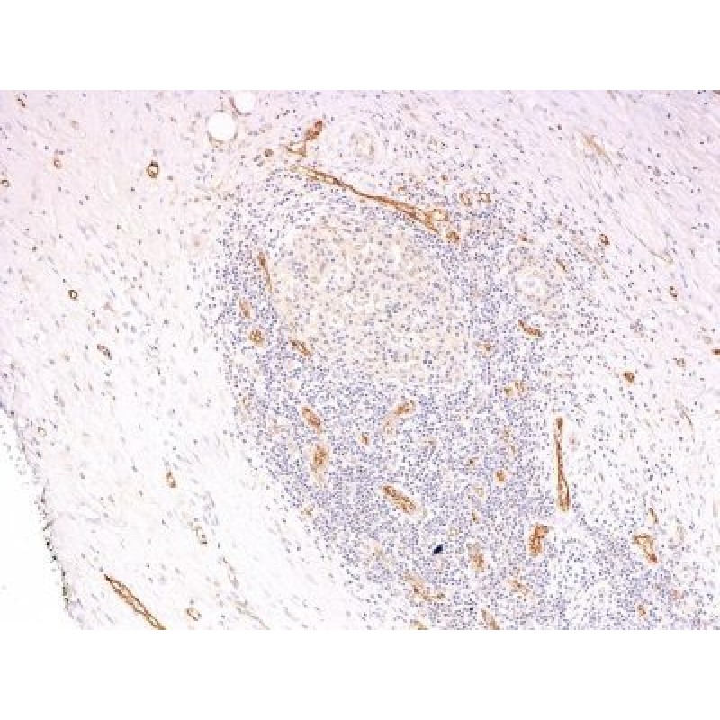 von Willebrand Factor(3E2D10 + VWF635), CF568 conjugate, 0.1mg/mL