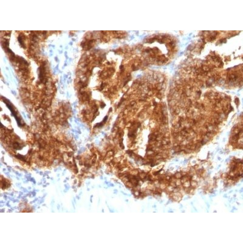 TAG-72 / CA72.4(CA72/733), CF568 conjugate, 0.1mg/mL