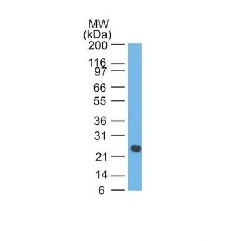 Human Lambda Light Chain(LcN-2 + ICO-106), CF568 conjugate, 0.1mg/mL