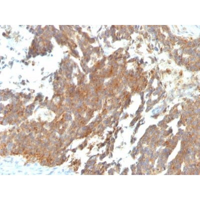 GnRH-Receptor (LHRH Receptor)(GNRHR/768), CF568 conjugate, 0.1mg/mL