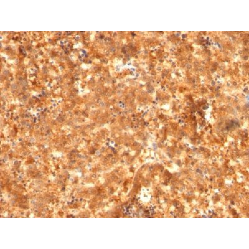AFP (Alpha Fetoprotein)(C2 + C3 + MBS-12), CF568 conjugate, 0.1mg/mL