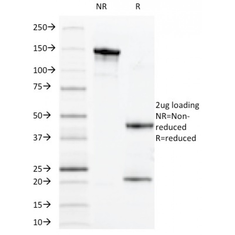 MUC1 / CA15-3 / EMA / CD227 (Epithelial Marker)(VU-11D1),  CF568 conjugate, 0.1mg/mL