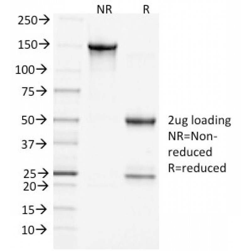 Clathrin, Heavy Chain(CHC/1432), CF568 conjugate, 0.1mg/mL
