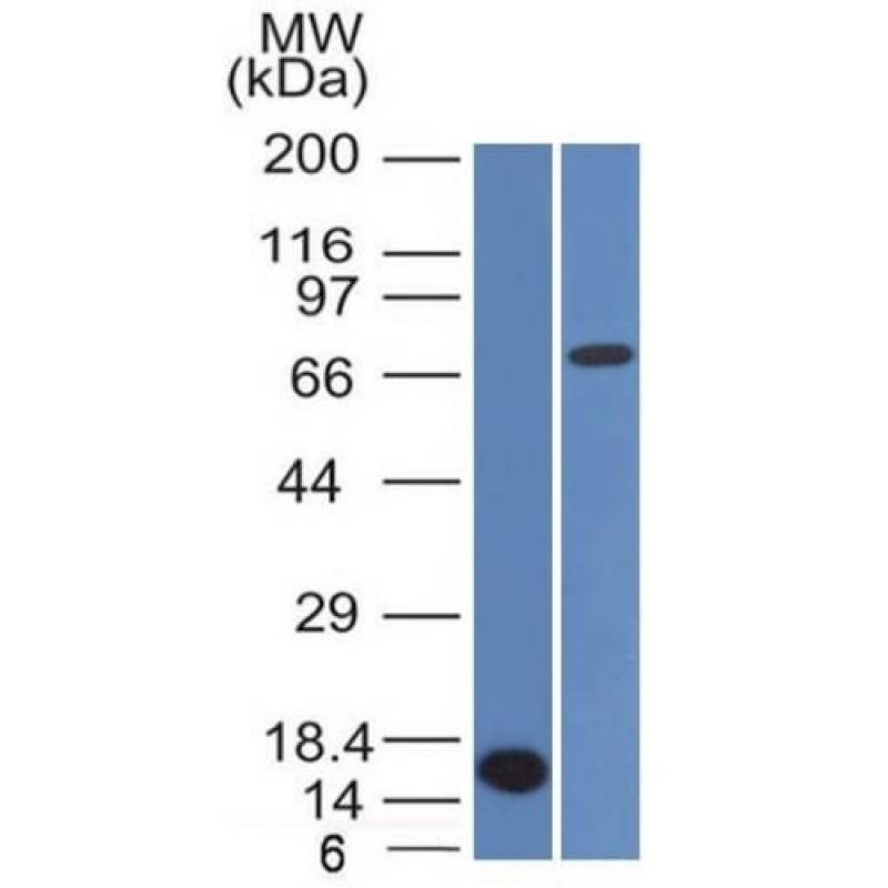 Bcl-6 (Follicular Lymphoma Marker) (BCL6/1475), CF568 conjugate, 0.1mg/mL