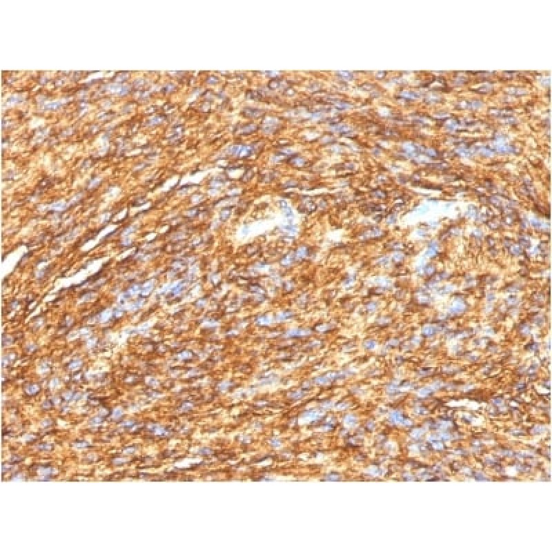 DOG-1 / TMEM16A (Gastrointestinal Stromal Tumor Marker) (DG1/1484), CF568 conjugate, 0.1mg/mL