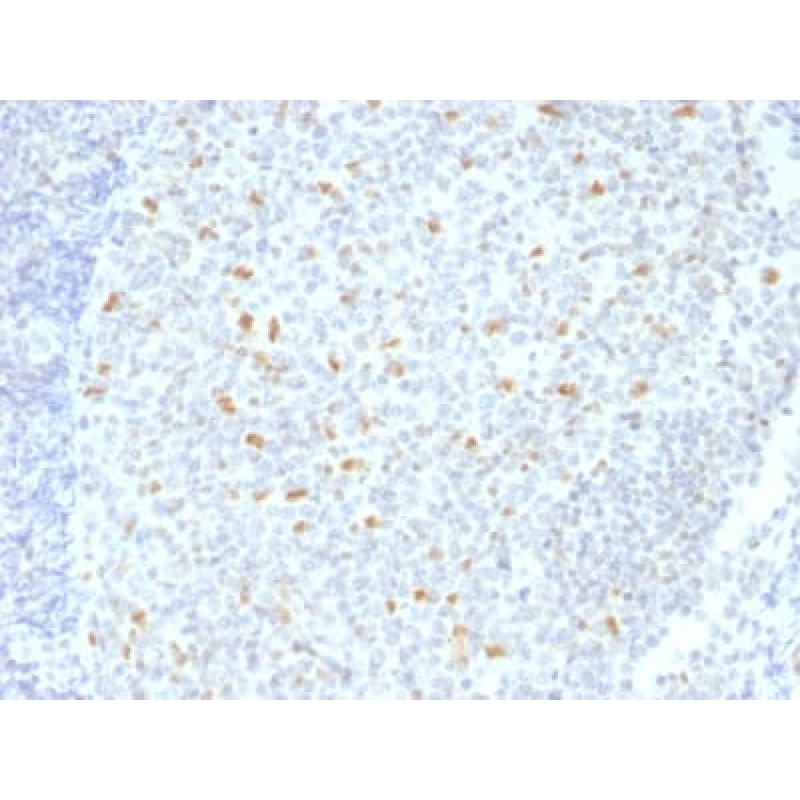 Bcl-6 (Follicular Lymphoma Marker) (BCL6/1526), CF568 conjugate, 0.1mg/mL