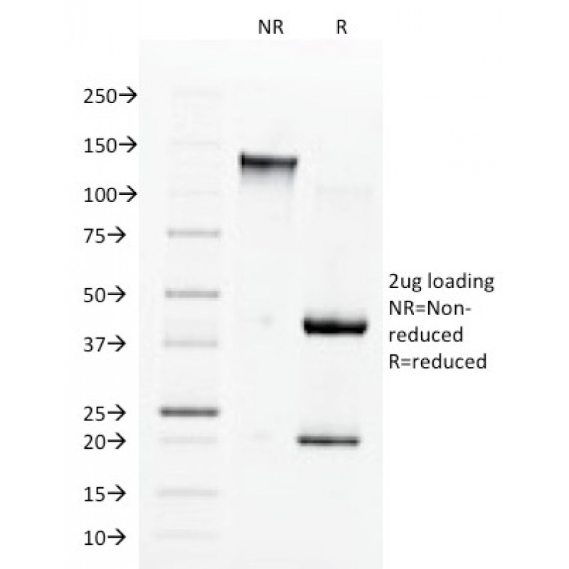 Biotium BNC681560-500, Angiotensin I Converting Enzyme (ACE) / CD143(9B9), CF568 conjugate, 0.1mg/mL