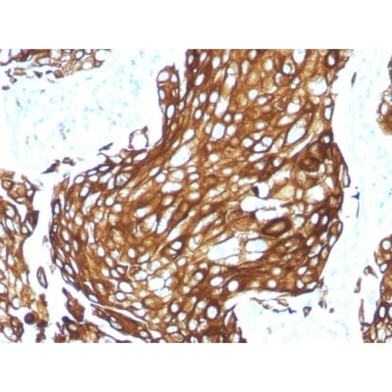 Cytokeratin, Acidic (Type I or LMW) (Epithelial Marker) (KRTL/1577R), CF568 conjugate, 0.1mg/mL