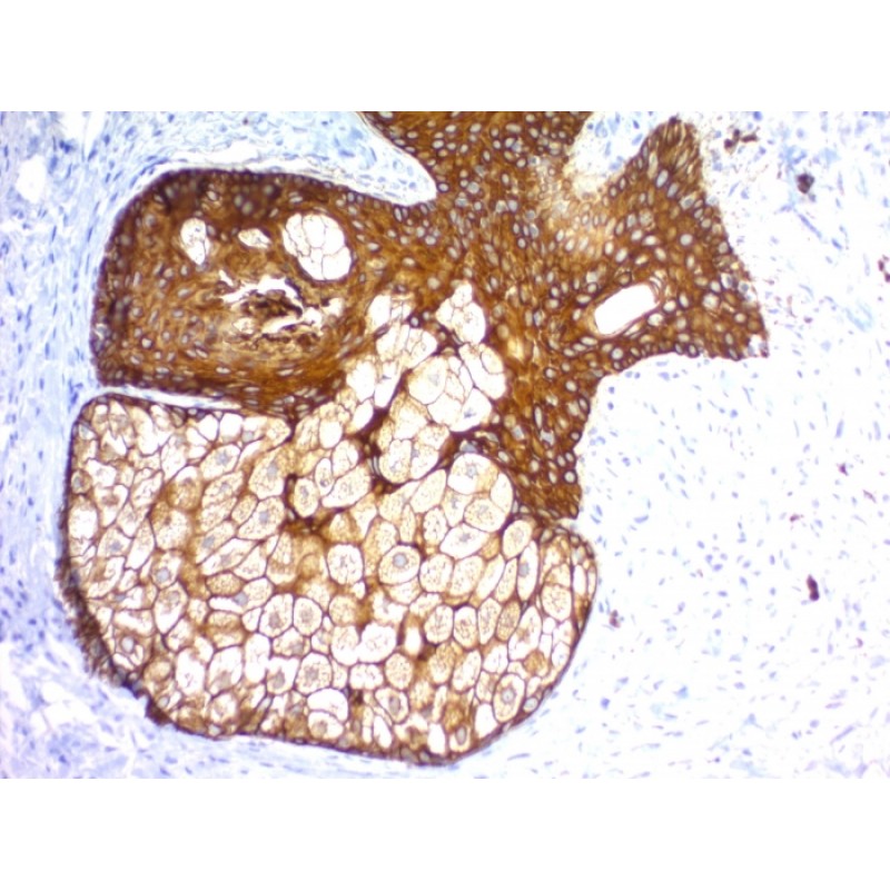 Cytokeratin, pan (Epithelial Marker) (KRTH/1576R + KRTL/1577R), CF568 conjugate, 0.1mg/mL